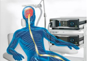 stimolazione magnetica stimolazione cerebrale